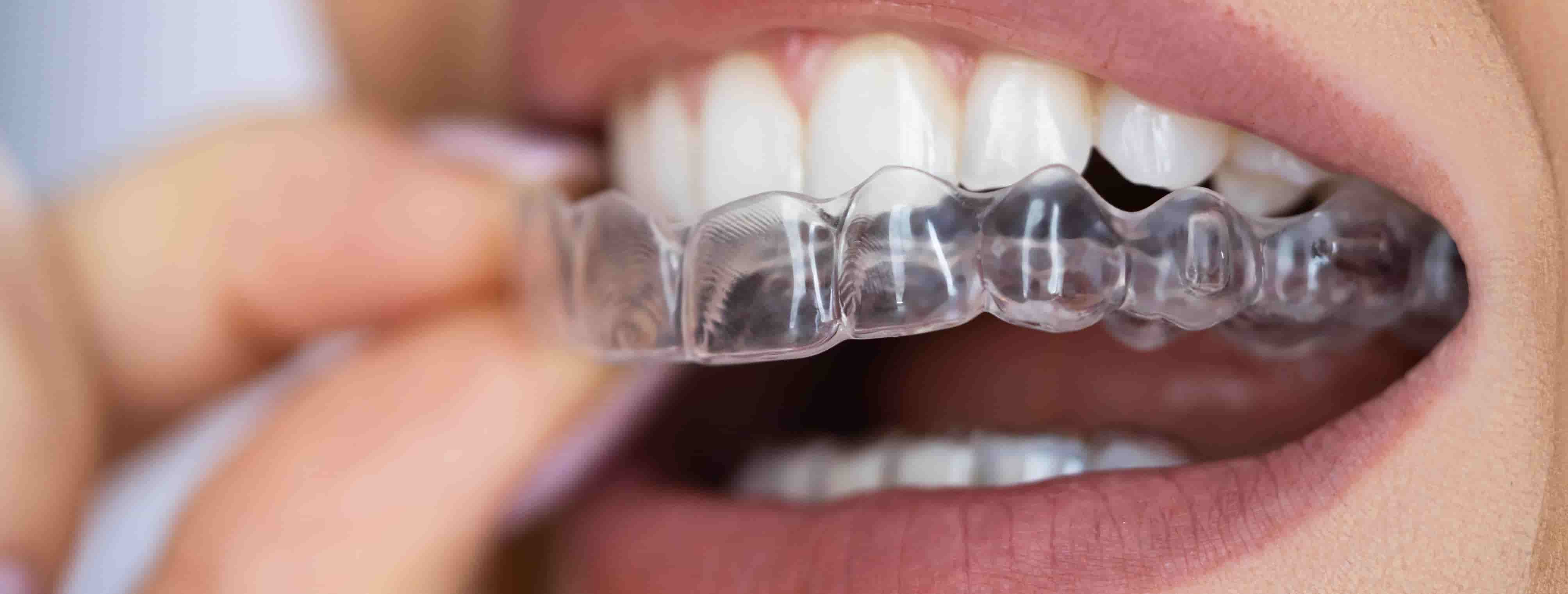 Why Choosing the Best Dental Clinic in Chennai is Vital for Your Oral Health