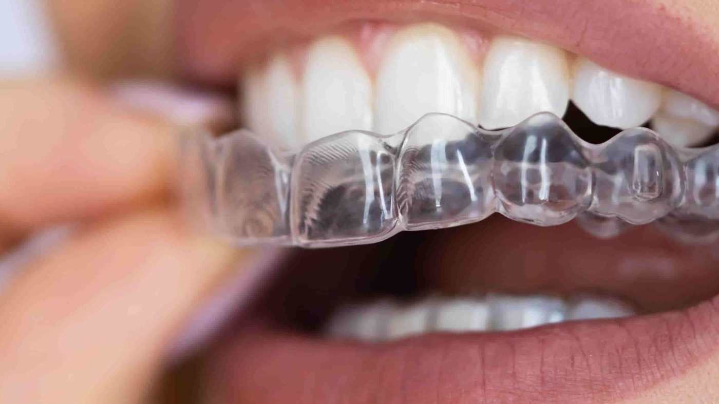 Why Choosing the Best Dental Clinic in Chennai is Vital for Your Oral Health