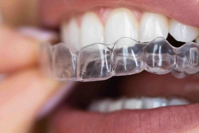 Why Choosing the Best Dental Clinic in Chennai is Vital for Your Oral Health